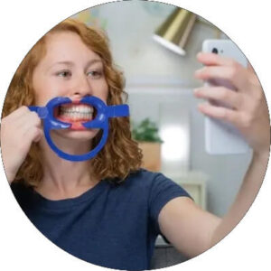 Custom Aligner Fabrication at The Waterfront Clinic Greenock