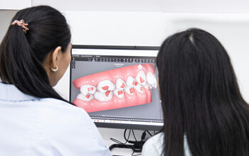 Custom Teeth Mould at The Waterfront Clinic Greenock