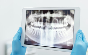 Teeth Scanning at The Waterfront Clinic Greenock