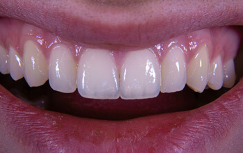 Good Teeth at The Waterfront Clinic Greenock